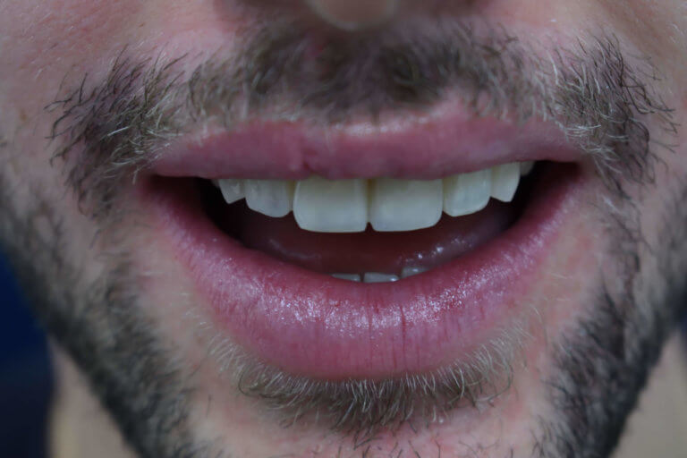 αισθητική οδοντιατρική Θεσσαλονίκη