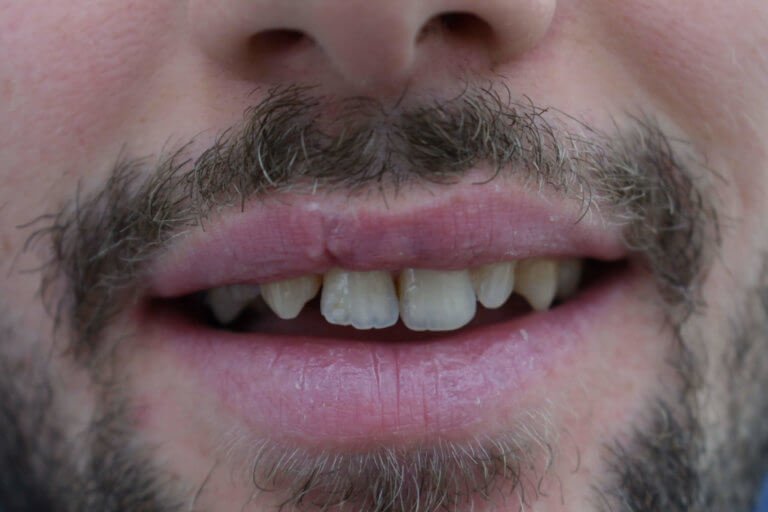 Αισθητική οδοντιατρική Θεσσαλονίκη