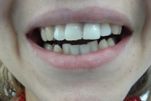 Όψεις Ρητίνης Θεσσαλονίκη