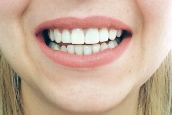 Όψεις Ρητίνης Θεσσαλονίκη